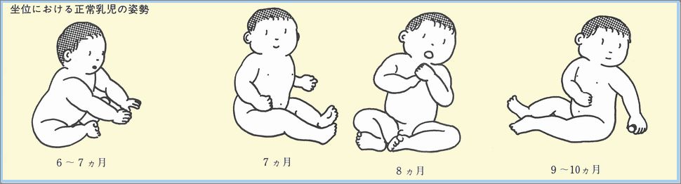 乳児健診 10ヶ月 こどもの疾患 太田東こども おとな診療所 こどもとおとなの病気について 気軽に相談できる診療所です